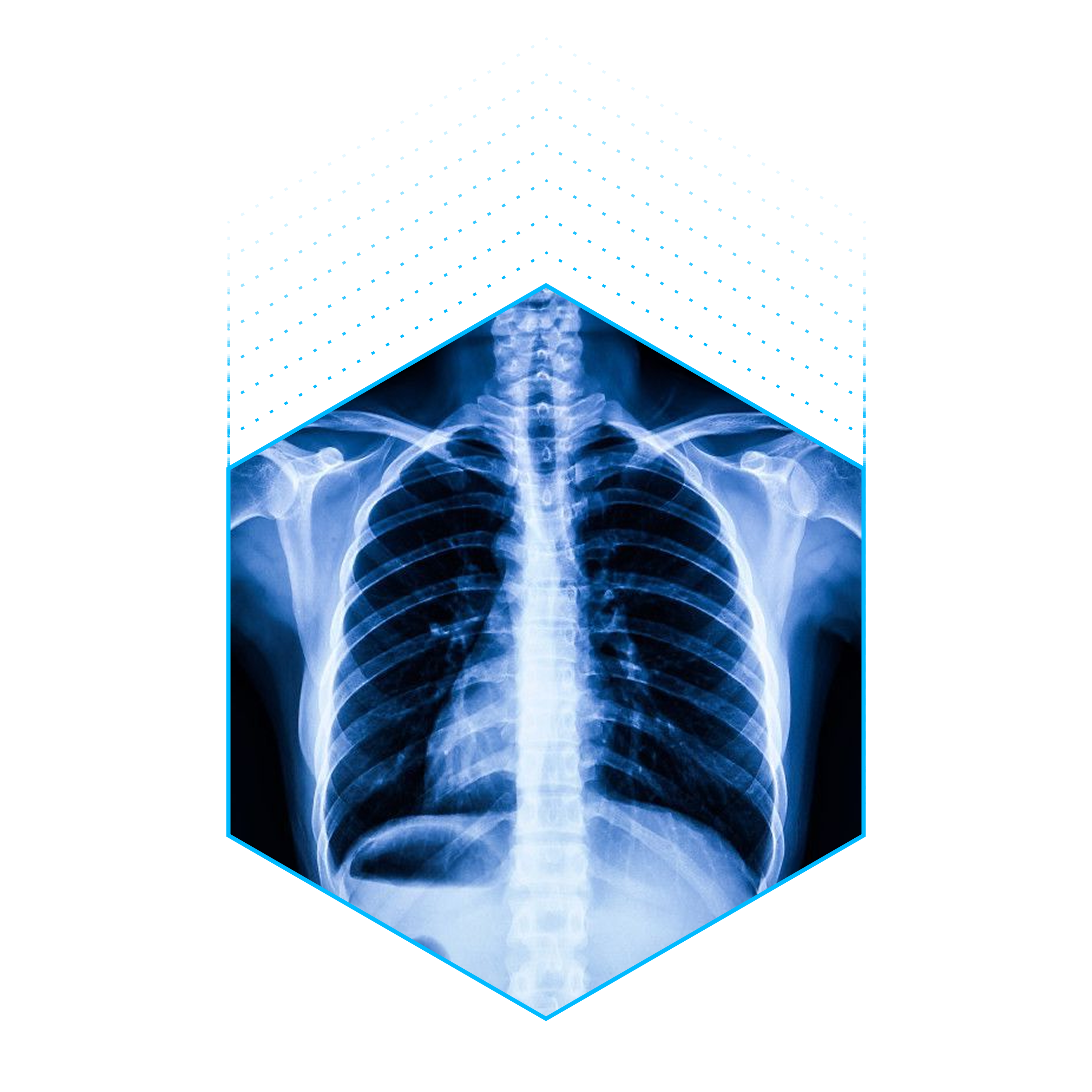 Chest X-ray in hexagonal frame
